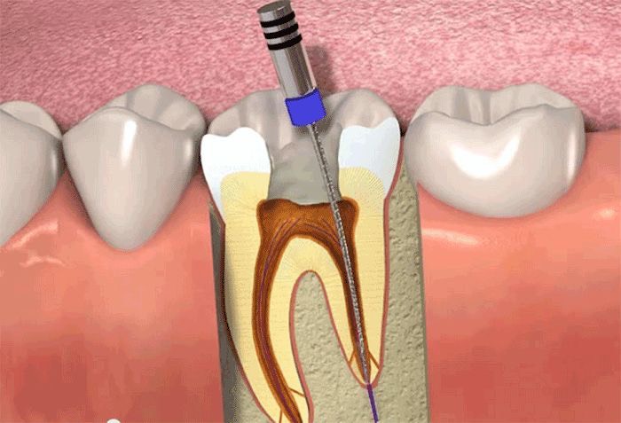 Khóa Học Nội Nha Đương Đại