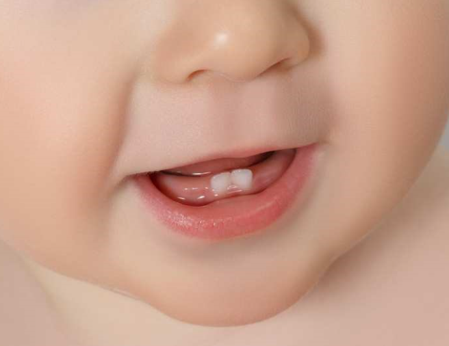 VÌ SAO TRẺ CHẬM MỌC RĂNG?