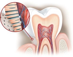 Nguyên nhân và cách điều trị ê buốt răng hàm 