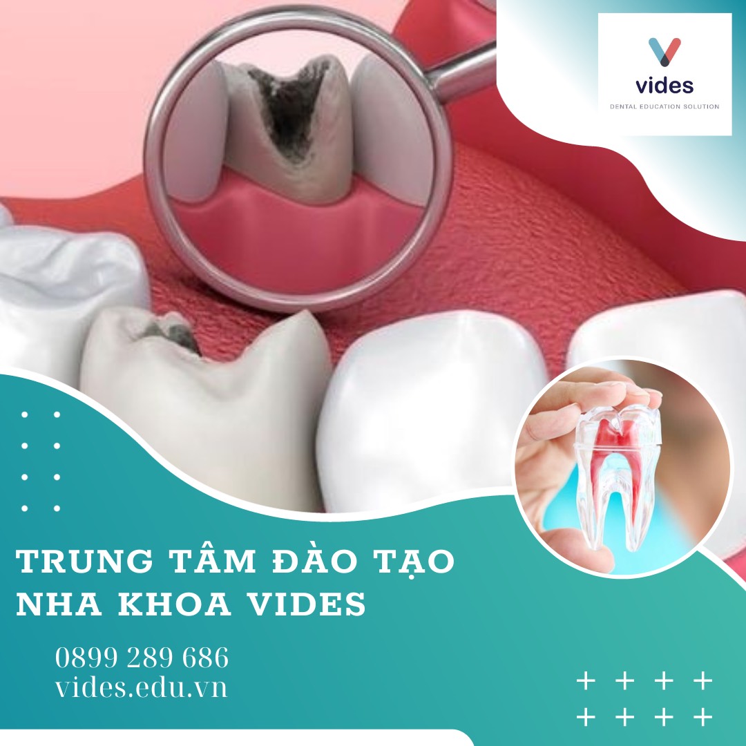 TUYỂN SINH KHÓA HỌC CHỈNH NHA TẠI TRUNG TÂM ĐÀO TẠO NHA KHOA VIDES